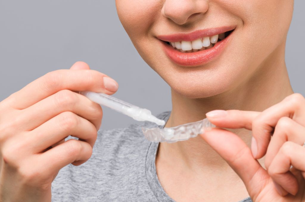 Teeth Whitening at Home: Tips and Tricks for a DIY Smile Makeover